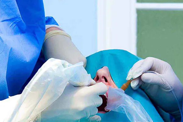 aperfeiçoamento em cirurgia oral menor